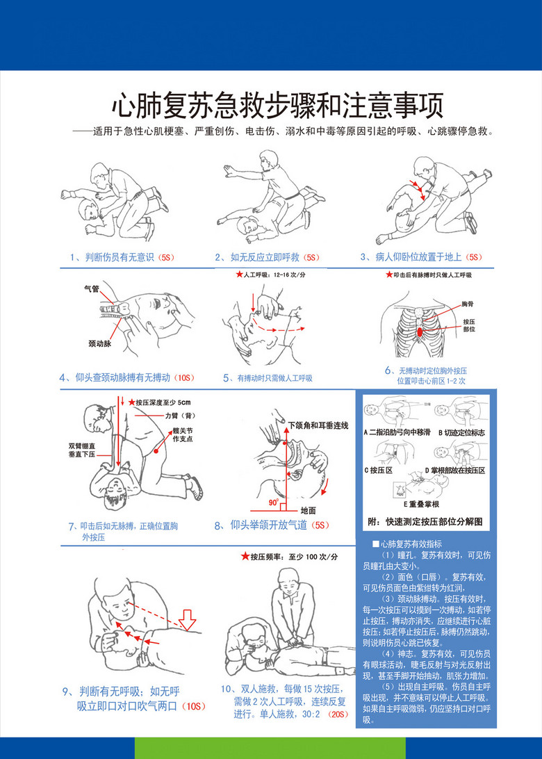 心肺复苏急救步骤图例2