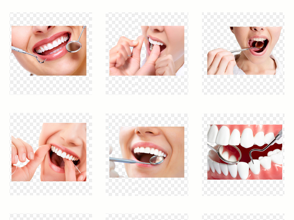 牙齿美白医院排名_医院冷光美白牙齿图片(3)