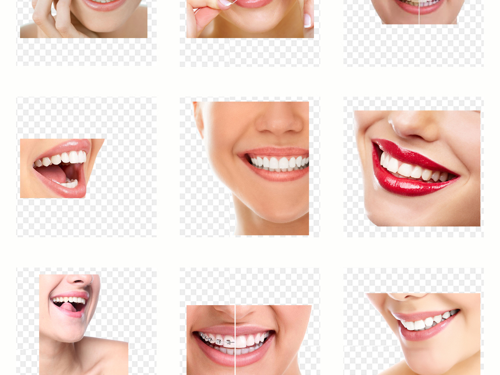 牙齿美白医院排名_医院冷光美白牙齿图片(2)