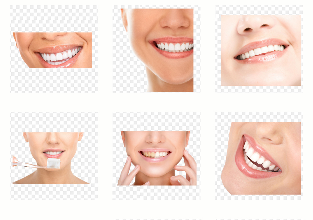 牙齿美白医院排名_医院冷光美白牙齿图片(2)